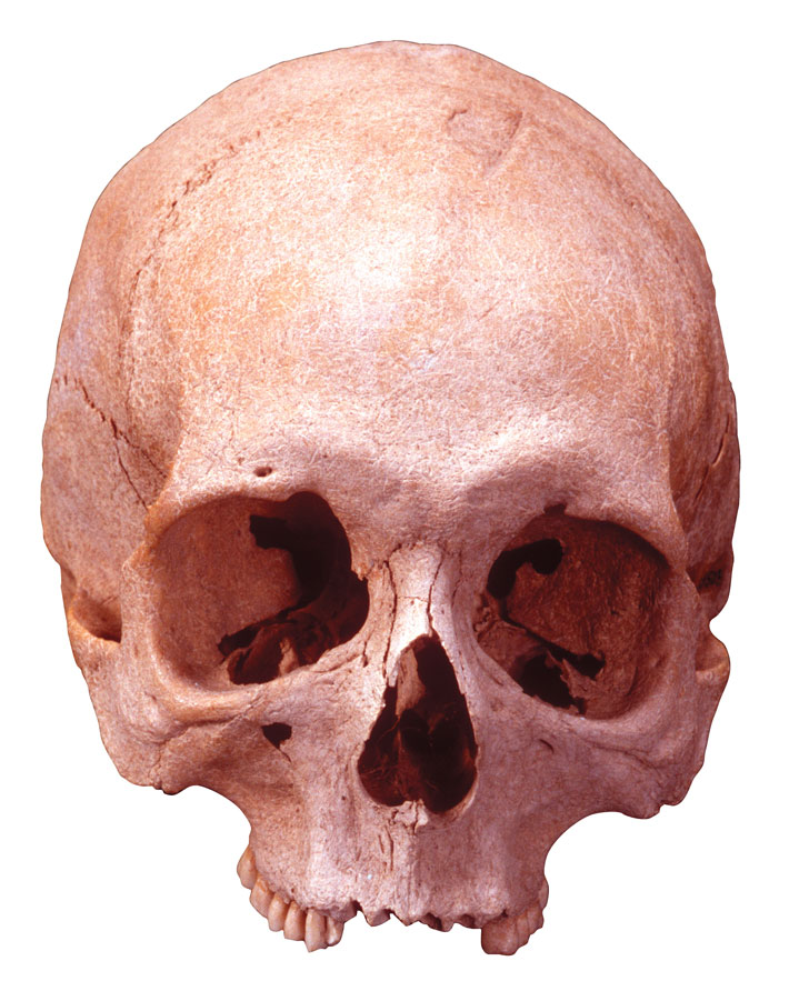 Australia Skull