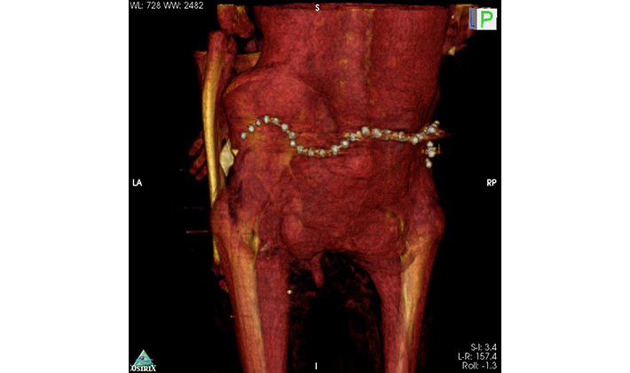 CT scan of the mummy of the Egyptian pharaoh Amenhotep I showing a golden girdle wrapped around his waist (Courtesy Sahar Saleem)